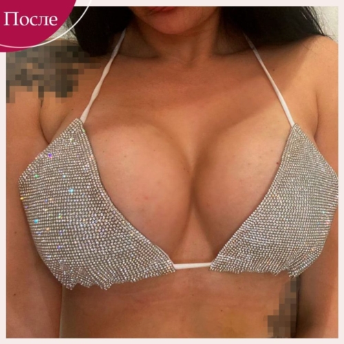 Увеличение груди в Киеве