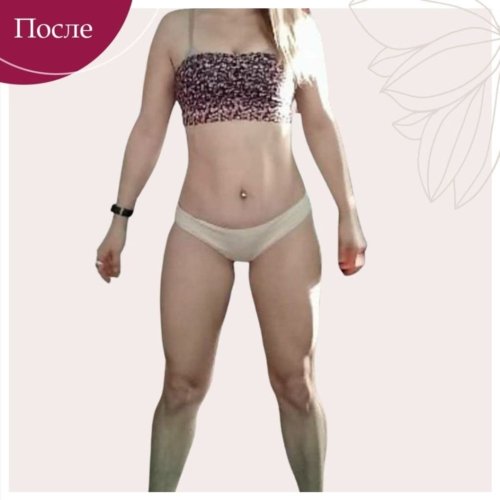 Липосакция и абдоминопластика
