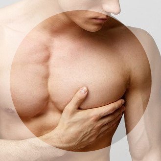 Лечение гинекомастии